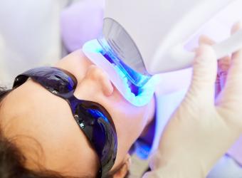 Blue Light Teeth Whitening: Is It Safe, and Does It Work?