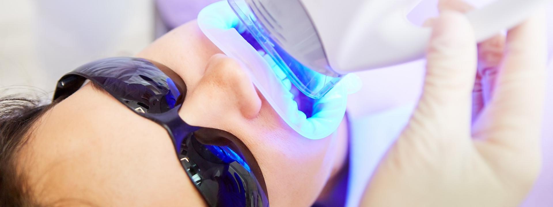 Blue Light Teeth Whitening