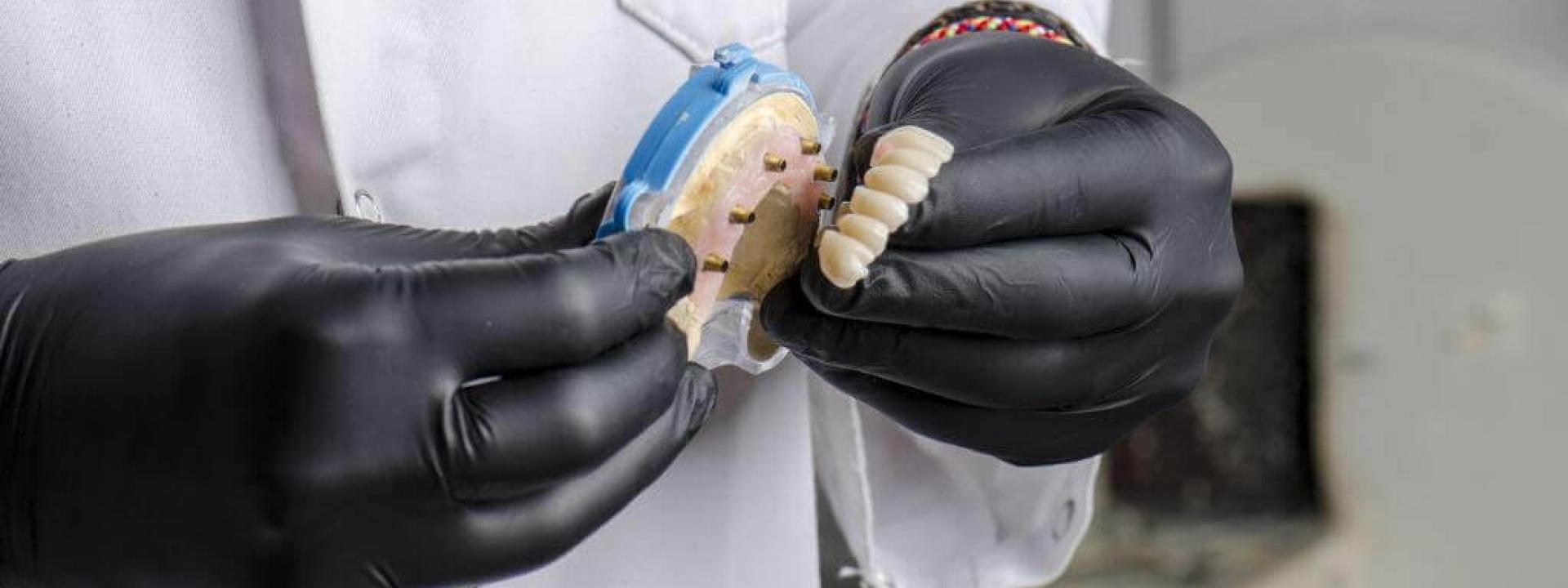 Implant-Supported Dentures